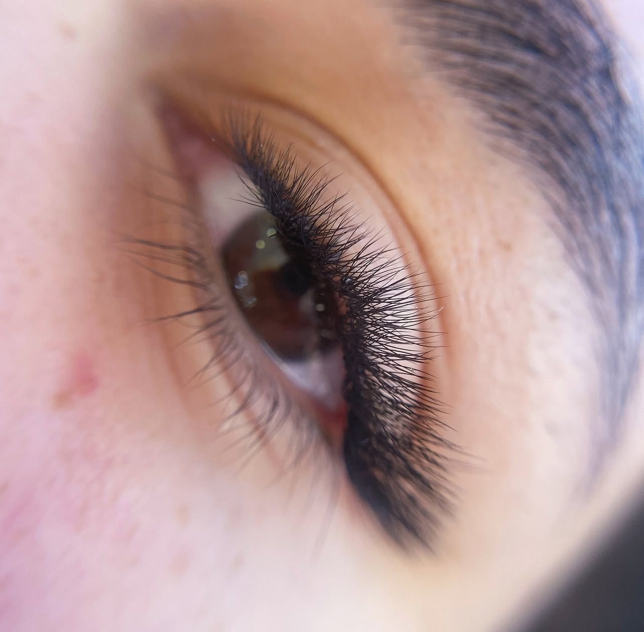 Fox Eye